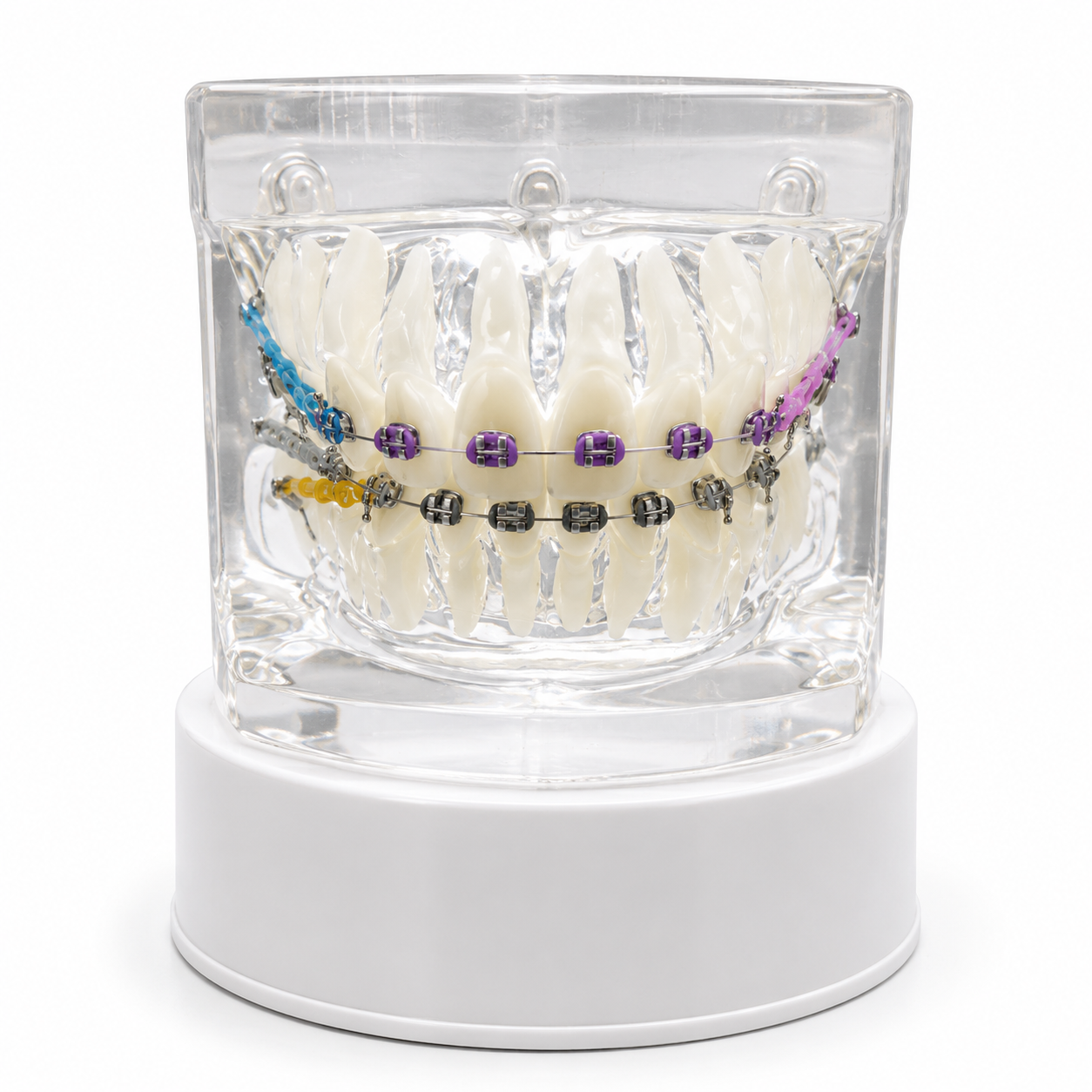 Maqueta Dental Transparente de Ortodoncia con Brackets y Microtornillos Maqueta Dental Transparente de Ortodoncia con Brackets y Microtornillos