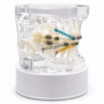 Maqueta Dental Transparente de Ortodoncia con Brackets y Microtornillos